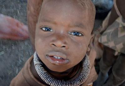 Himba village elder Kaokoland Namibia chief paracetamol malaria traditional medicine western encounter
